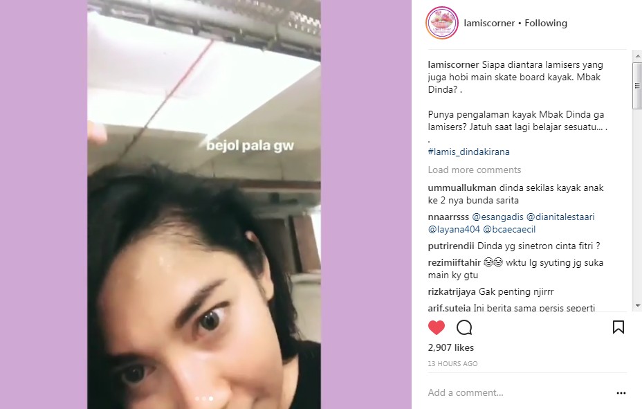 Dinda Kirana Tunjukkan Kepala Benjol Pasca Terjatuh dari Papan Skateboard